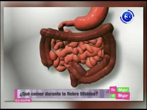 ¿Es seguro comer aguacate con tifoidea?
