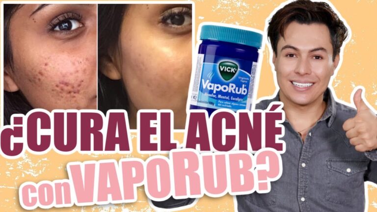Ventajas y desventajas del Vick Vaporub