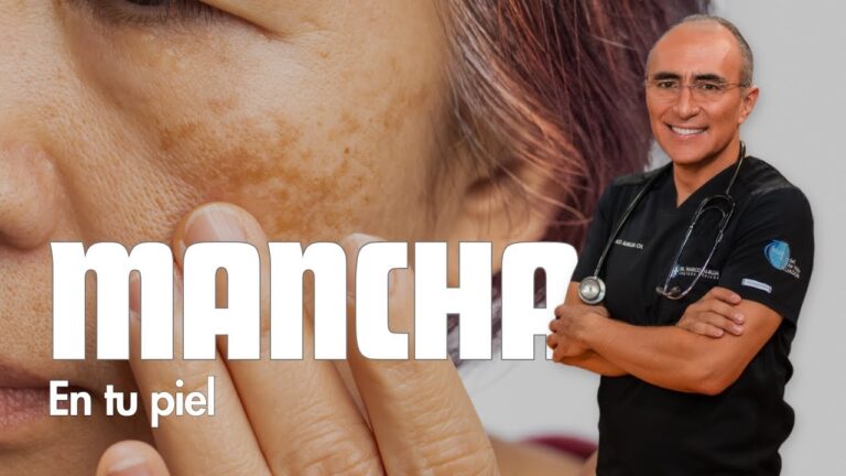 Maneras efectivas para quitar el pa&ntilde;o facial