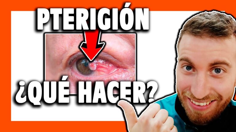 Eliminar el pterigión de ojo de forma natural