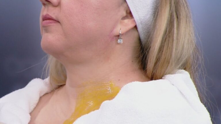 5 remedios caseros para quitar arrugas del cuello