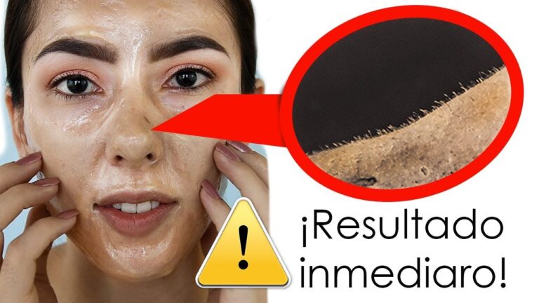Mascarilla Casera Efectiva para Eliminar Puntos Negros en la Cara