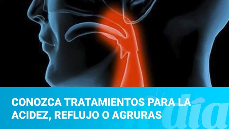 Medicamentos Efectivos para Aliviar las Agruras